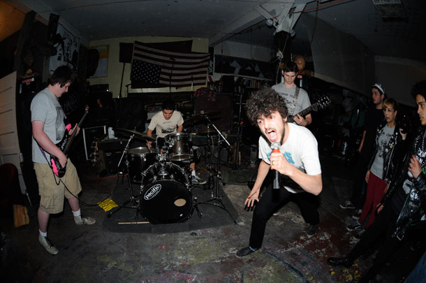 Migraine